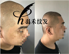 纹发机构