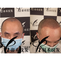 羽禾纹发前后案例