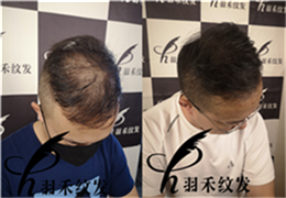重庆纹发、客户案例 