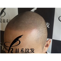 羽禾纹发客户案例