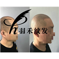 成都纹发前，纹发后 