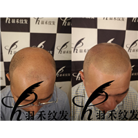 羽禾纹发前后