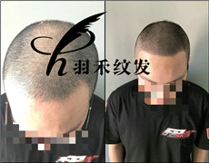 成都羽禾纹发案例
