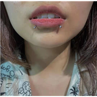 泰州唇钉