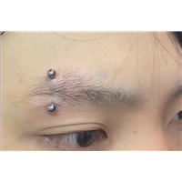 泰州眉钉