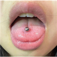 泰州穿孔穿刺