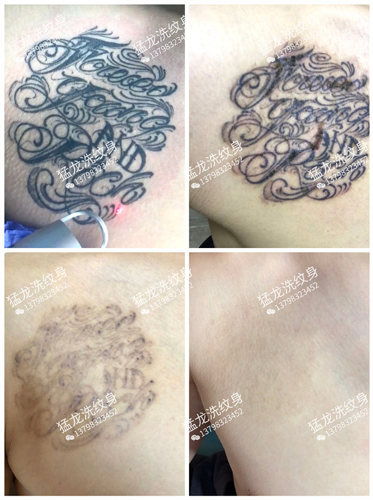 东莞洗眉东莞洗彩色纹身