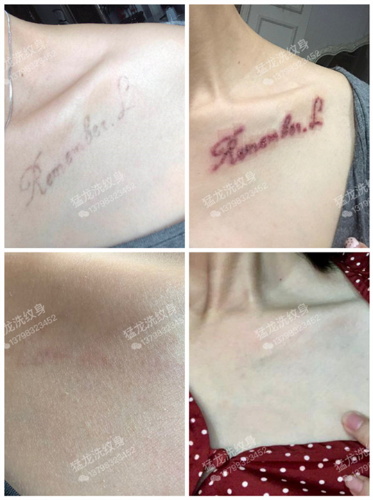 东莞洗眉东莞洗彩色纹身