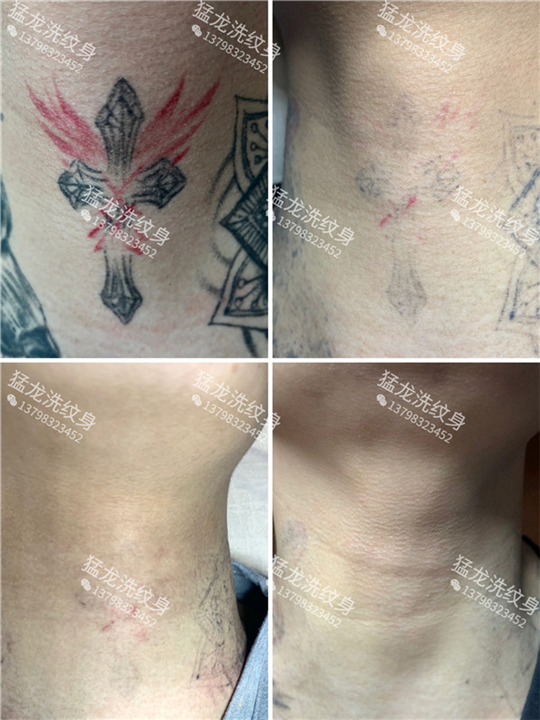 东莞洗眼线热线