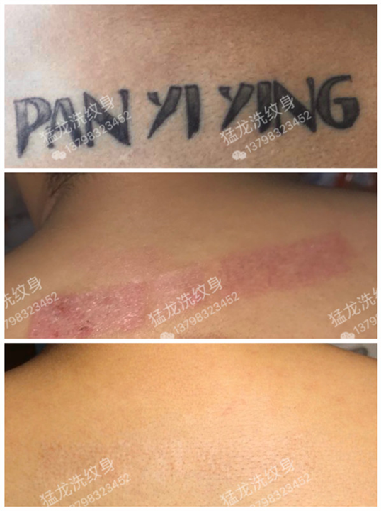 东莞道滘洗纹身