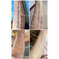 东莞洗纹身专家认证咨询电话