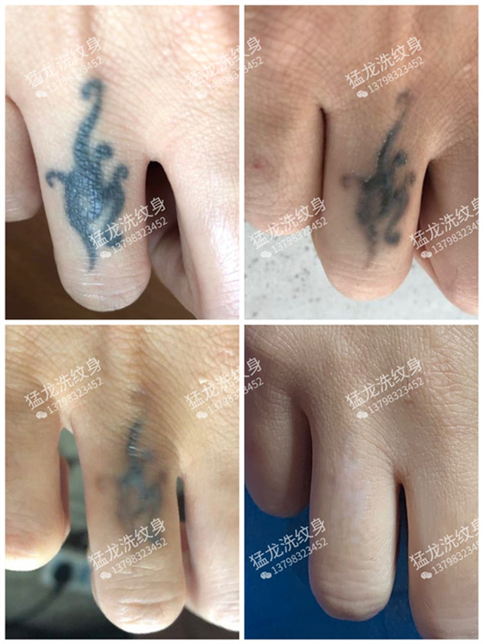 广州洗眉广州洗眼线