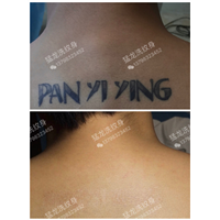 广州洗纹身多少钱洗纹身贵不贵