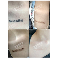 广州洗眼线广州洗彩色纹身