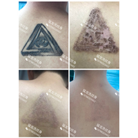 广州洗彩色纹身广州哪里可以洗纹身