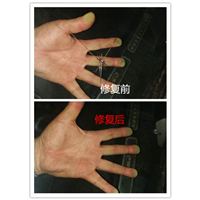 濮阳汽车凹陷修复#濮阳汽车玻璃修复 