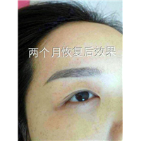 仁寿洗纹身价格价格多少合适