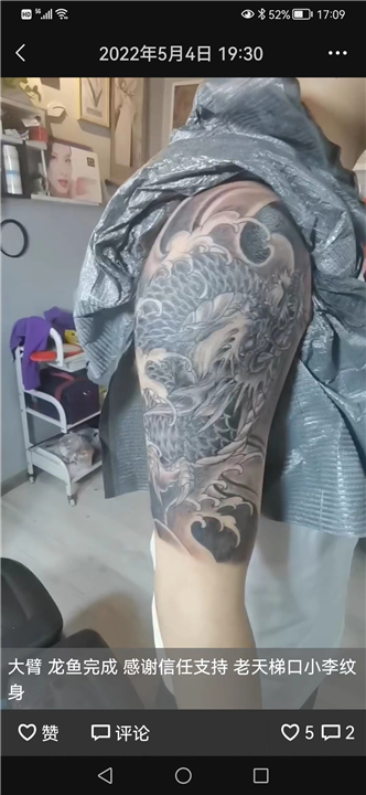仁寿纹身疤痕遮盖皮秒价格多少