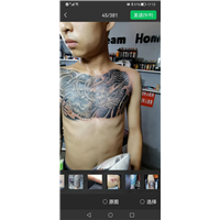 仁寿纹身疤痕遮盖价格多少合适