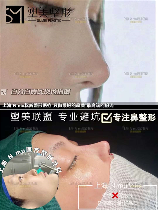 上海娜慕医疗美容医院