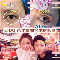 上海做眼综合哪家好 