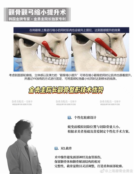金勇圭磨骨