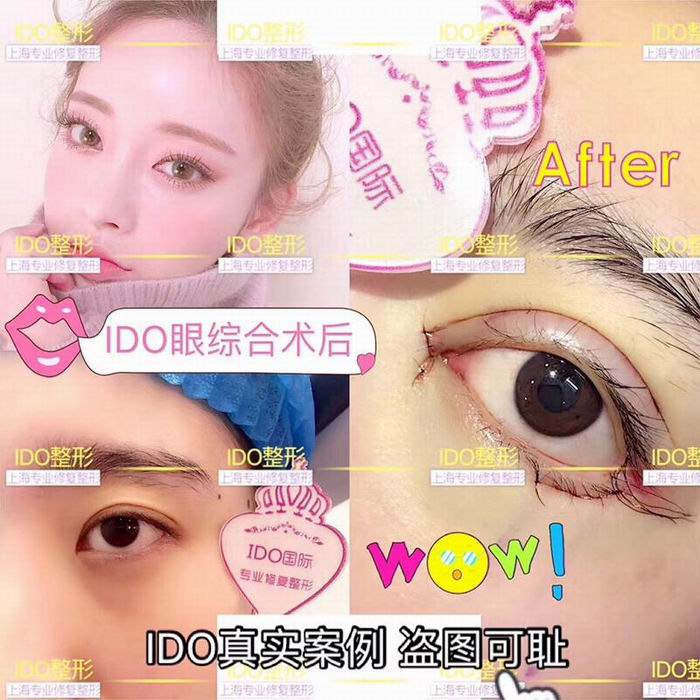 上海眼部整形医院 