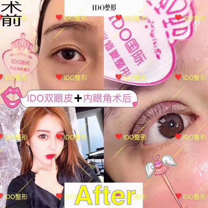 上海眼部整形医院 
