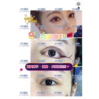 上海眼综合整形 