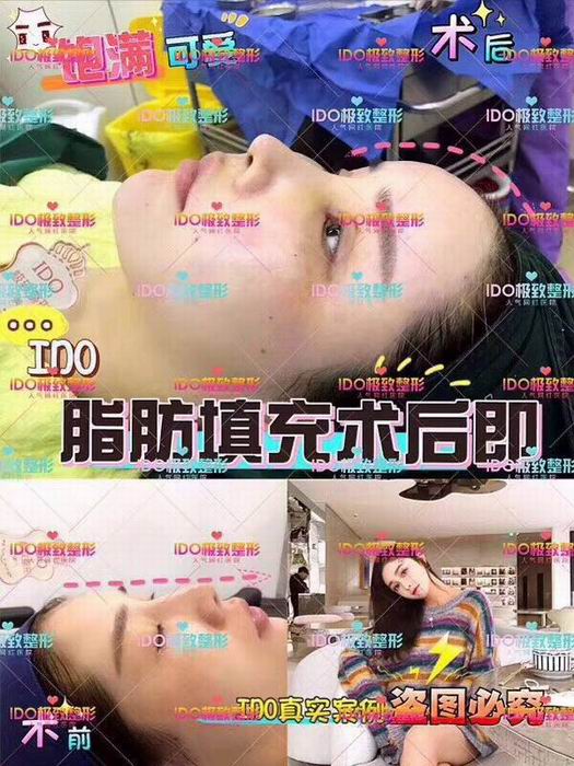 上海人气整形创始人 