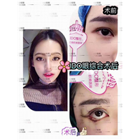 上海专业整形修复 