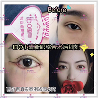 上海人气眼部整形 