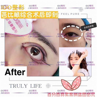 上海眼部整形 