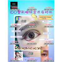 上海整形眼综合 
