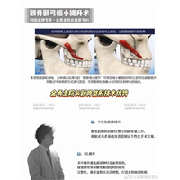 金勇圭磨骨