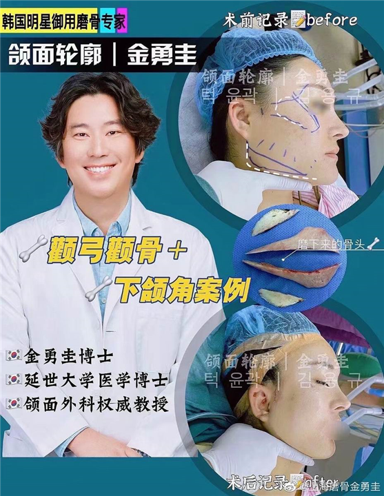 金勇圭医生