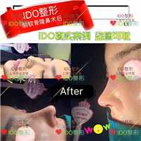 上海鼻综合整形 