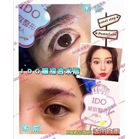 眼综合整形医院 