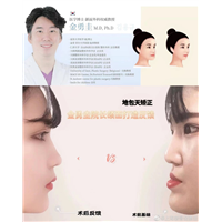 金勇圭颌面整形