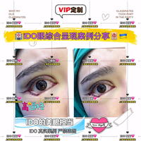 整形眼综合 