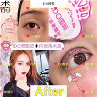 上海眼部整形医院 