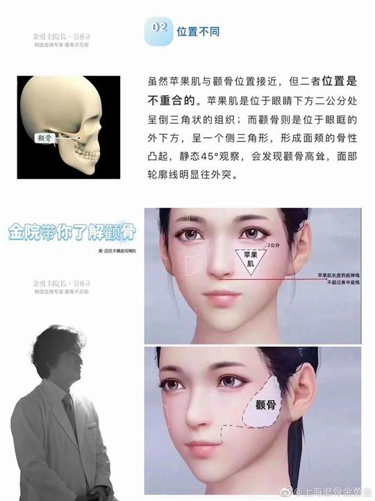 金勇圭磨骨
