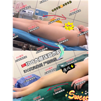 上海整形医院 