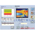 双能X光骨密度仪M 