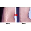 西宁哪里可以去疤痕
