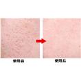青海哪里可以去疤痕