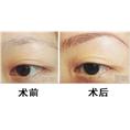 纹眉前后图