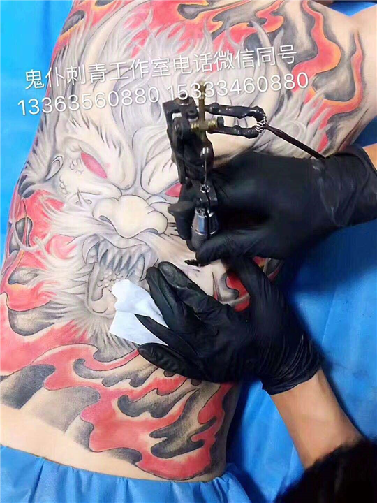 晋城纹身激光洗纹身 