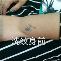 安阳洗纹身|安阳洗纹身哪家好
