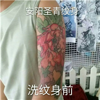 安阳洗纹身|安阳洗纹身价格